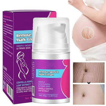 GuangJing Remove Stretch Mark Cream - 60g